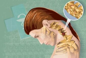 Reflex symptoms of cervical osteochondosis