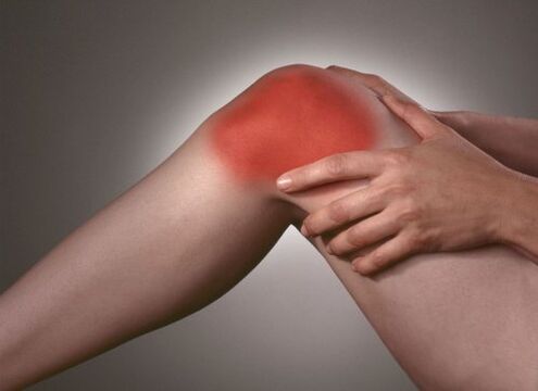 Arthrosis of the knee joint