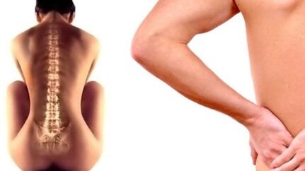 Back pain in the lower back of the back
